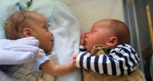 twins birth, preemie twins, Premature birth, babies, miracle, healthy babies, how to make birth easy, easy birth,